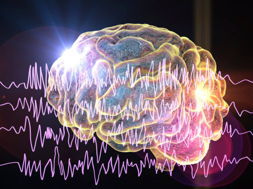 Ketamin v léčbě super-refraktorního epileptického stavu